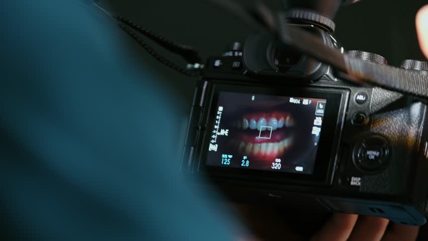 Dentist doctor taking picture of female patient. Dentist doctor photographing teeth with a machine after treatment. Clean white teeth appear on the camera’s screen.
