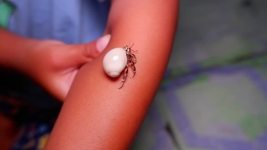 Hermit Crab Crawling on a Child
