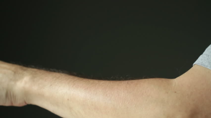 Person scratching at itchy skin on their arms. Frontal view, recorded with