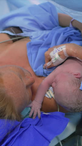 A just-born baby is placed on the mother's chest as the surgeon completes the cesarean section operation. A touching moment of maternal bonding, love, and the first embrace after childbirth in a