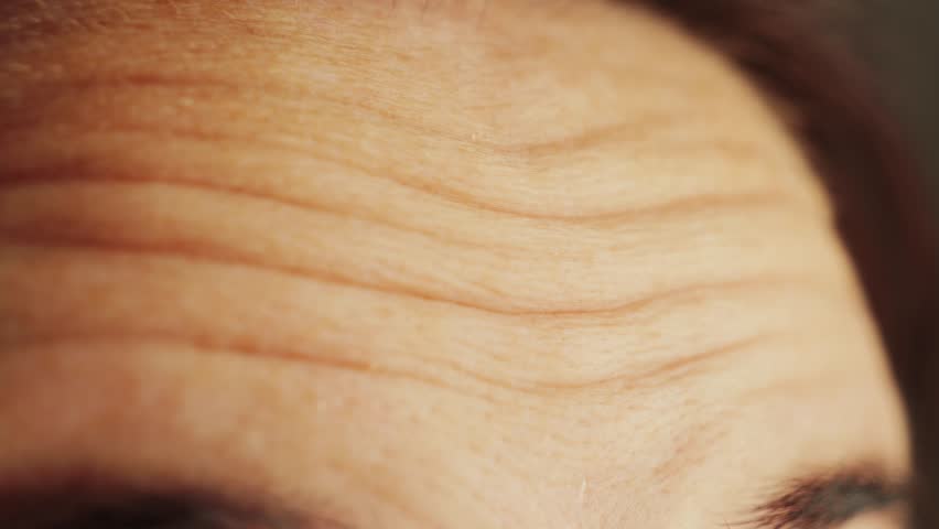 Close-up of a woman's forehead with wrinkles, woman looks surprised and wrinkles her forehead. High quality 4k footage