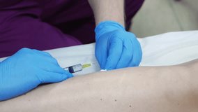 Close-up treatment of varicose veins with injections. Injection into a vein in the leg. Dilated varicose veins on the legs. - Powered by Shutterstock - Get 15% off with code: PIKWIZARD15