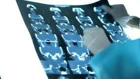 Doctor Checking Patient Diagnose. Neurologist Looking MRI Scan. Laboratory Clinic Brain Research. Radiology MRI Scan.Brain Screening Procedure.Therapist Diagnose Patient MRI Scan.Doctor Medical Report - Powered by Shutterstock - Get 15% off with code: PIKWIZARD15