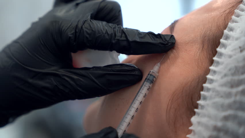 Beautician doctor makes botulinum toxin injection in the forehead of young beautiful woman. Close up 4k shot