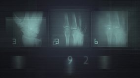 Futuristic Medical Imaging Interface Showing Digital Diagnostic Analysis. Detailed visualization of a futuristic holographic interface displaying medical diagnostic images and data.  - Powered by Shutterstock - Get 15% off with code: PIKWIZARD15