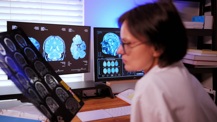 The doctor analyzing a patient's MRI scan to diagnose brain conditions and to plan treatment and the medication