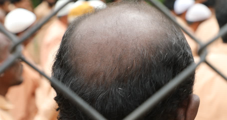 Rear view of Bald head man Kakinada Andhra Pradesh India 31st March 2025