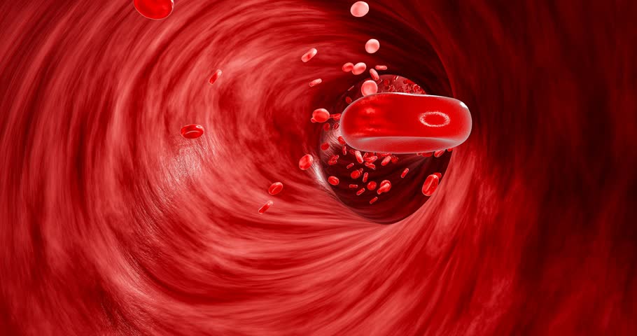 Detailed 3D visualization of vascular blockage caused by unhealthy eating habits, including fast food, sugary drinks, alcohol abuse, and trans fats, contributing to heart attacks and strokes. 3D rende