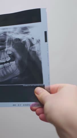 Female dentist analyzes a patient's X-ray, detecting cavities, inflammation, and other dental conditions.