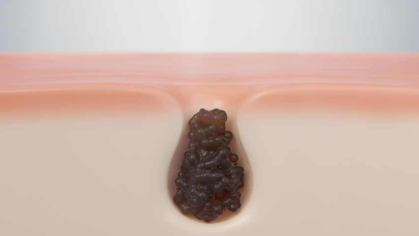 3d animation of cosmetics solution blackhead removal, Cleansing foam absorb dirty skin Water deep skin cleaning,