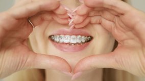 A young woman smiling with metal dental braces on teeth and showing love heart shape with her hands. Concept of orthodontics, dental care, oral hygiene, and healthy smile. - Powered by Shutterstock - Get 15% off with code: PIKWIZARD15