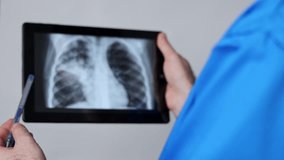 doctor with face surgical mask holding lungs radiography scan showing part infected with bacterial pneumonia.man in blue suit with stethoscope on neck holding tablet pointing with hand.chest x ray - Powered by Shutterstock - Get 15% off with code: PIKWIZARD15