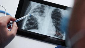 doctor with face surgical mask holding lungs radiography scan showing part infected with bacterial pneumonia.man in blue suit with stethoscope on neck holding tablet pointing with hand.chest x ray - Powered by Shutterstock - Get 15% off with code: PIKWIZARD15