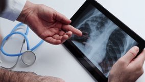 doctor with face surgical mask holding lungs radiography scan showing part infected with bacterial pneumonia.man in blue suit with stethoscope on neck holding tablet pointing with hand.chest x ray - Powered by Shutterstock - Get 15% off with code: PIKWIZARD15