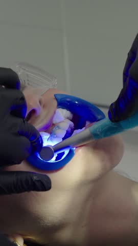 Dentist applying LED light activation for professional tooth whitening treatment