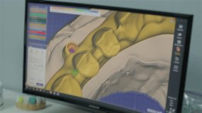 Dental CAD Software Designing Zirconia Crowns - Powered by Shutterstock - Get 15% off with code: PIKWIZARD15