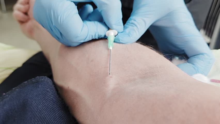 Medical professional wearing gloves inserts IV needle into patient s arm, demonstrating a sterile environment, precision technique, and proper injection procedure