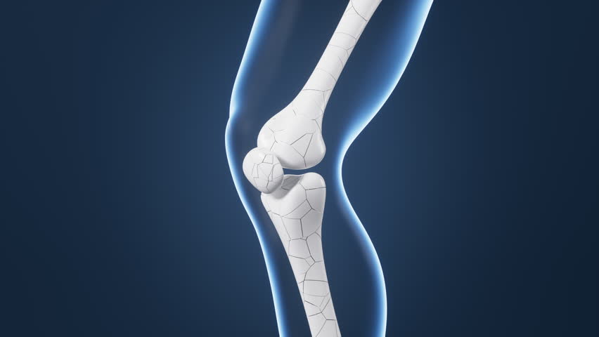Human kneecap model, arthrophlogosis, joint swelling, joint pain, Biological and medical concepts, 3d rendering. Motion Graphic.