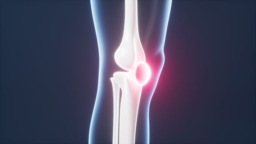 Human kneecap model, arthrophlogosis, joint swelling, joint pain, Biological and medical concepts, 3d rendering. Motion Graphic.