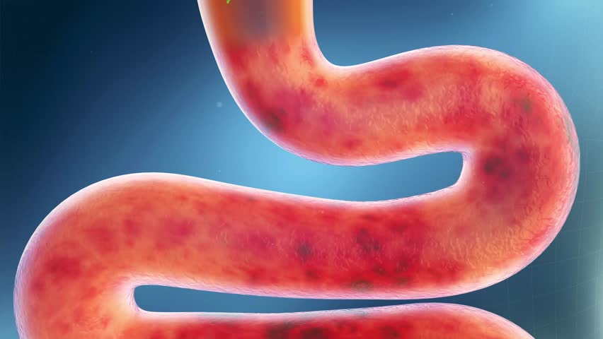 Intestinal probiotics clean up stool, promote intestinal peristalsis, activate intestinal motility, and remove toxins. Intestinal and digestive health concept, 3D animation.