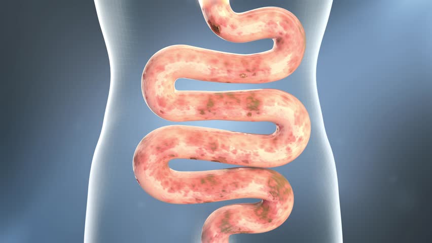 Intestinal probiotics promote intestinal peristalsis, activate intestinal motility, promote digestion, and remove toxins. Clean up stool, intestinal and digestive health concept, 3D animation.