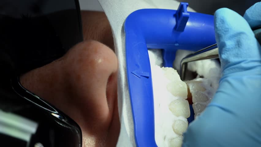 Beautful lady receiving dental care at a well-equipped clinic with modern healthcare practices