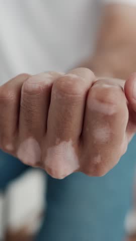 Man Takes and Shows Pills Vitamins or Drugs Tablet in Hand. Close up Hand Holding Variety of White Pills on Palm. Medication Tablets, Capsules From Unrecognizable Patient Hand. Health Care Concept 4k