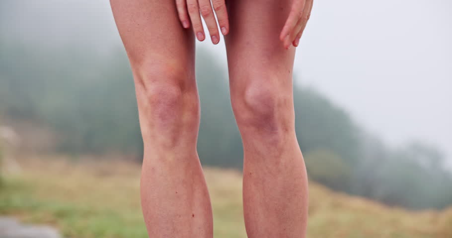 Woman, legs and knee pain outdoor for fitness, exercise and cardio workout accident or training in mountain nature. Joint issue, wellness emergency and athlete person with running injury in forest