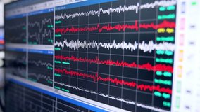 Monitor depicting brain waves during neurosurgery. Close up. Brain surgery. - Powered by Shutterstock - Get 15% off with code: PIKWIZARD15