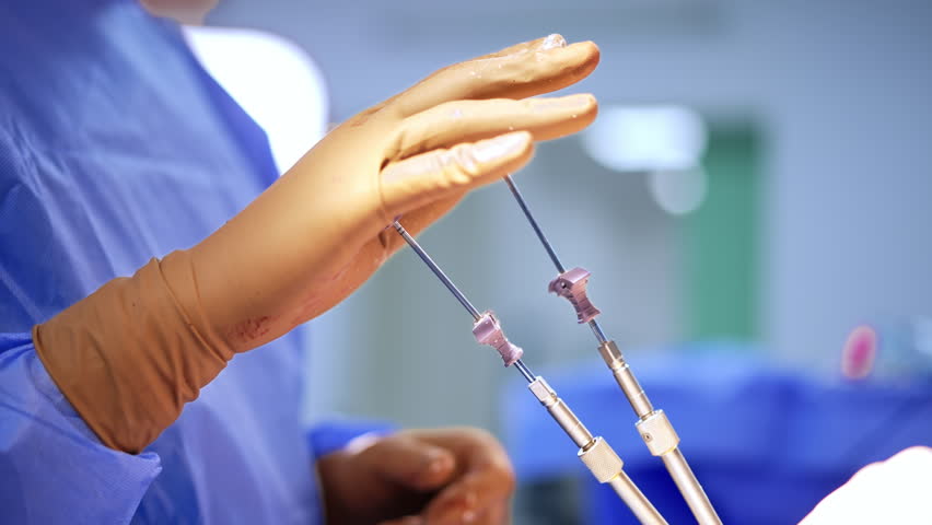 Minimally invasive surgery. A surgeon carefully maneuvers surgical instruments during a minimally invasive procedure in a sterile environment.