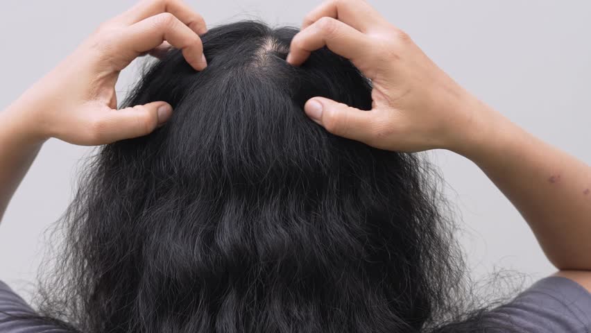 Women with hair loss dryness and frizziness	