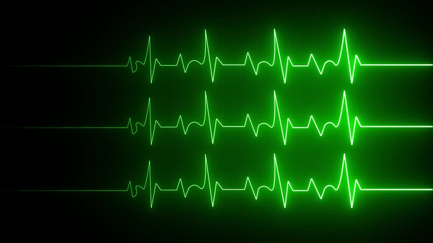 Abstract neon three heartbeat signal icon animation background . Heart beat pulse. Electrocardiogram show heart beat line.