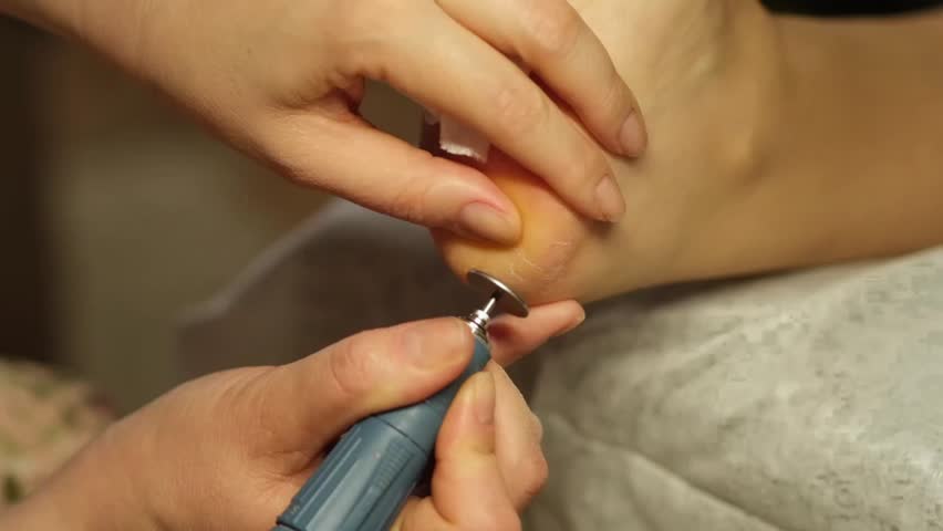 Expert hands provide a soothing pedicure, addressing foot care using specialized tools in a tranquil salon, ensuring a refreshing experience for clients.