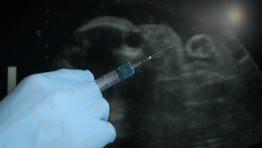 Gynecologist hold syringe in hand. A view of injection with vaccine in man's hand against ultrasound screen.