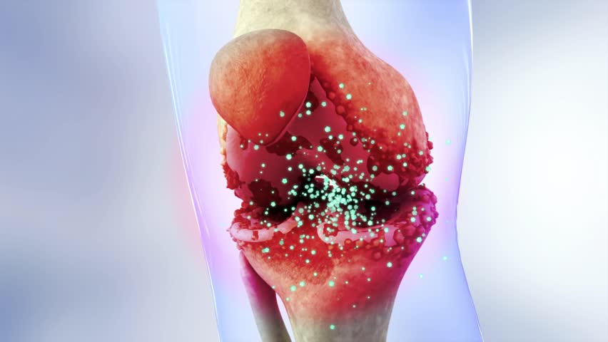 Knee recovery, drug molecules to relieve knee pain and prevent osteoarthritis. Orthopedics and orthopedic treatment of rheumatoid arthritis, 3D rendering.