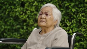 senior woman injury to eyelid and nose swelling from an accident - Powered by Shutterstock - Get 15% off with code: PIKWIZARD15