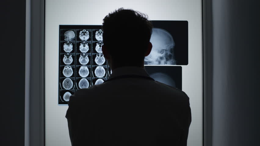 Doctor reviews X-ray images for diagnosis.