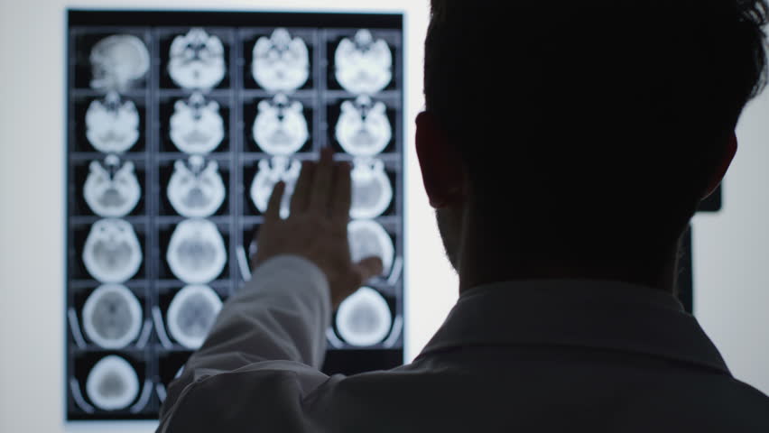 Doctor examines brain X-rays on lightbox.
