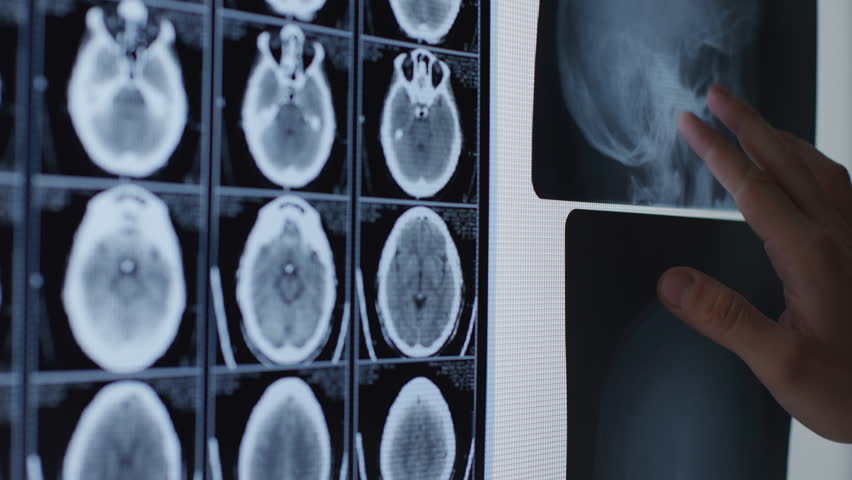Medical professional examining X-ray and CT brain scans.