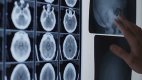 Medical professional examining X-ray and CT brain scans. - Powered by Shutterstock - Get 15% off with code: PIKWIZARD15