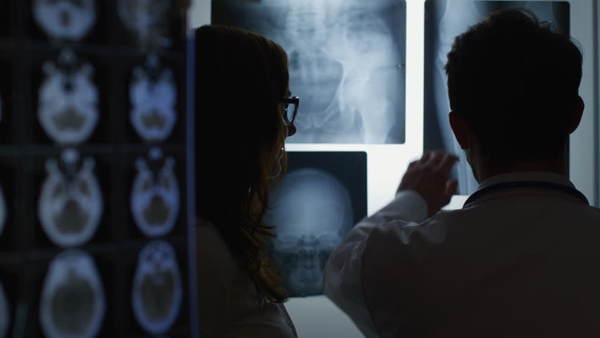 Doctors examining X-ray images in a medical setting.