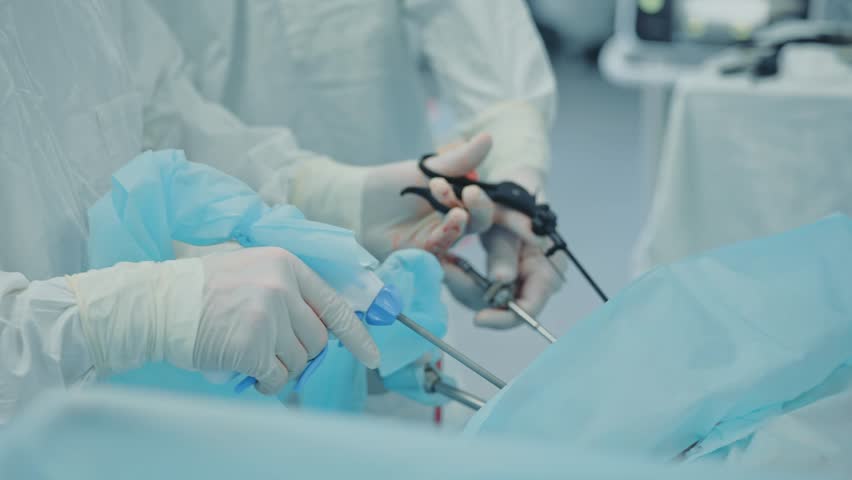 Surgical procedure demonstrating kidney stone removal in operating room setting