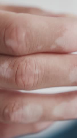 One Male Hand Holding Pill Yellow Omega 3 Gel Capsule Close-up. Pill Fish Oil Supplement. Concept of Health Care Vitamin and Medicine. Omega 3 Fish Oil Capsules, Vitamin D for Man Wellbeing Life 4k
