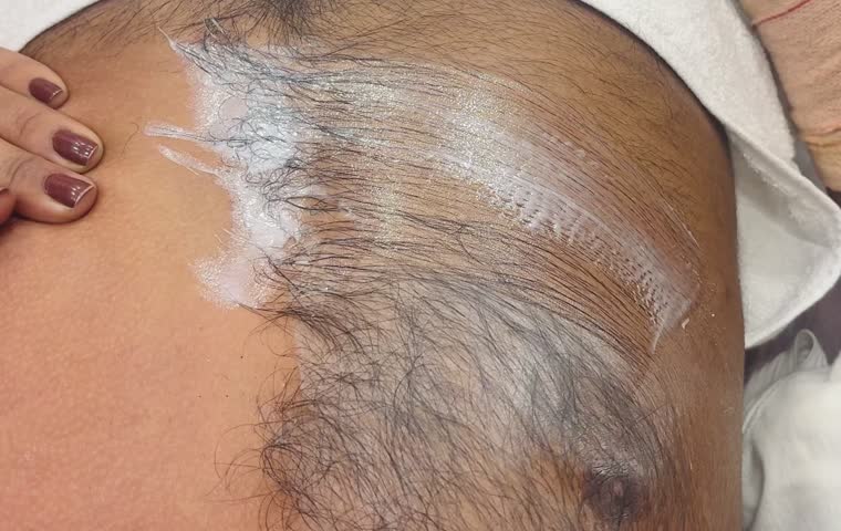 Professional way of Waxing man's chest hairs in seconds at beauty saloon.