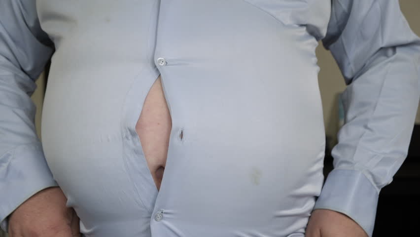 Overweight man's shirt buttons unbutton and come off on stomach due to big belly close-up, person suffering from obesity
