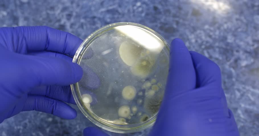 Open the petri dish with gloved hands and show the mold colonies against the blue laboratory table.