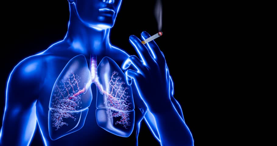 Human lung damage depicted by a cigarette embedded into diseased lungs, showing how smoking leads to cancer, emphysema, COPD, respiratory failure, conditions linked to tobacco abus.3D model.