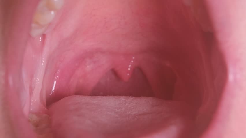 Close-up video that demonstrates clear anatomical features and characteristics of the inside of the throat