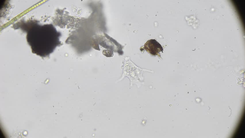 Microscopic view of moving amoeba in water sample, timelapse shows fast activity of single-celled organisms from a puddle ecosystem.