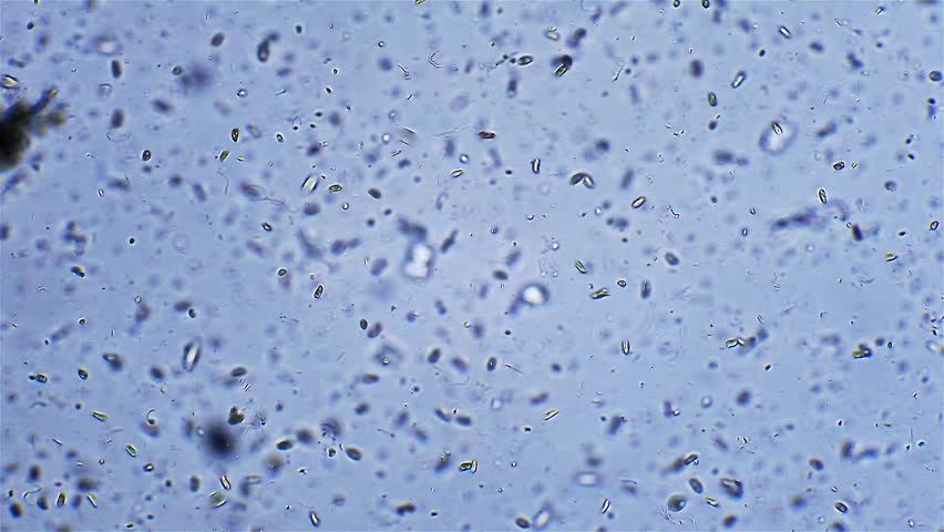 Micro organism Ciliates - microscope magnification
